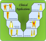 Figure 2. Diagram illustrating various clinical applications of mineral trioxide aggregate.