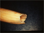 Figure 2  The root surface of the sperm whale’s tooth depicting the area where the tooth grows as the exposed coronal surface erodes from friction.