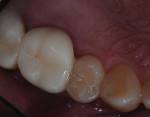 Occlusal character detail.
