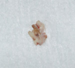 Figure 6. The excess cement retrieved from the implant-crown interface.