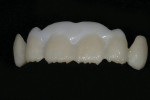 A photograph of the Deep Dentine layer after it was fired.