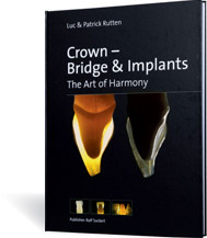 Crown-Bridge & Implants: The Art of Harmony by AEGIS Dental Network