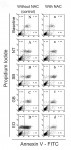 Figure 2  Cell viability, apoptosis, and cell death assays for the baseline (no adhesive treatment) and different adhesive extract groups in the absence and presence of NAC. The levels of cell viability were determined using Annexin V-FITC and propid
