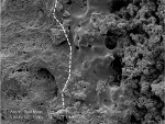 Figure 8  High-magnification view of interface (dashed line) between laser-damaged root surface (right) and unaffected adjacent mineralizing biofilm (left). Bar = 20 nm at an original magnification of 1,500x.