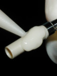 Figure 6 CATA being made with composite resin on stock PEEK temporary abutment.