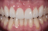 (1.) Dental instrument cleaning protocols.(1.) Dental instrument cleaning protocols.
