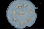 Figure 16. Modified dies with die spacer and lingual wax additions are duplicated with PVS silicone duplicating material.