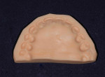 Figure 11. Putty matrix made from milled iTero cast with original iTero dies. Putty matrix will be used later for accuracy checks of refractory dies.