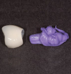 Figure 18 An abutment replica has been created that is 50 microns smaller than the actual abutment.