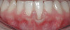 Fig 3. Vasoactivity of Dental LA Drugs.