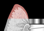 Figure 2  The tissue zone is defined as the tissue coronal to the implant-abutment interface. Contour change and thinning of the peri-implant tissues in this zone can lead to tissue discoloration due to abutment shine-through effect.