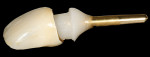 Figure 31  A cementing-die replica was made from bis-acryl material. This custom-fabricated die allows the indirect and extraoral cementation of the final crown.