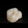 (19.) The abutment was coated with a composite bonding resin on the incisal half.