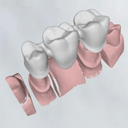 Delcam Dental Solutions by Delcam
