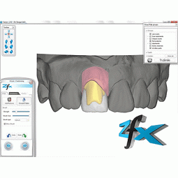 Zfx Dental CAD Design Software by Zimmer Biomet Dental