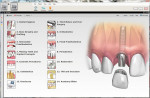 Figure 5 Consult-PRO™ Dental Patient Education Software 2011 provides detailed information from every dental specialty, from general dentistry, implants, oral surgery, periodontics, orthodontics, and endodontics.