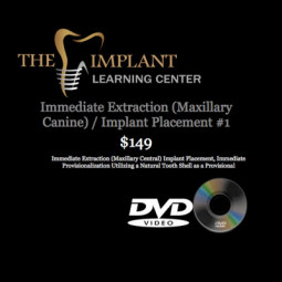 Surgical Series DVD: Immediate Extraction (Maxillary Canine) Implant Placement by The Implant Learning Center