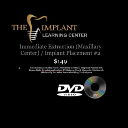 Surgical Series DVD: Immediate Extraction (Maxillary Central) Implant Placement by The Implant Learning Center