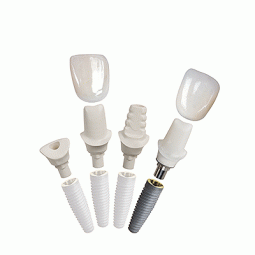 Open Platform Inclusive® Tooth Replacement Solution by Glidewell Laboratories