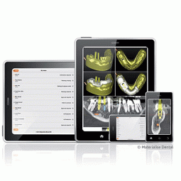 SurgiGuide® by Materialise Dental, Inc