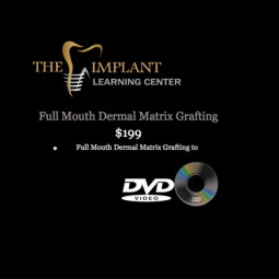 Surgical Series DVD: Full-Mouth Dermal Matrix Grafting to Correct Advanced Gingival Recession by The Implant Learning Center