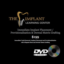Surgical Series DVD: Immediate Implant Placement and Provisionalization in a Maxillary Central Edentulous Site by The Implant Learning Center