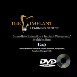Surgical Series DVD: Immediate Implant Placement in Multiple Anterior Sites by The Implant Learning Center