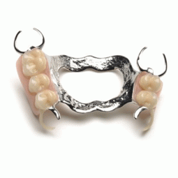 Metal Cast Partials by Assured Dental Lab