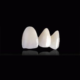 DAL Partial Prep Veneer by Dental Arts Laboratories, Inc.
