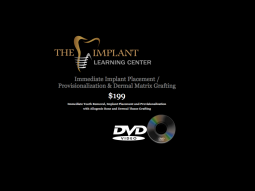 Surgical Series DVD: Immediate Tooth Removal, Implant Placement & Provisionalization with Allogenic Bone and Dermal Tissue Grafting by The Implant Learning Center