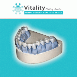 Vitality Milling by Vitality Dental Arts