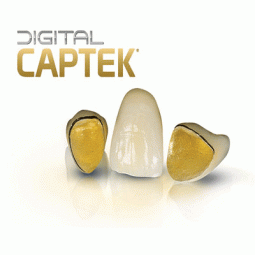 Digital Captek by Argen Corporation