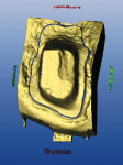 Figure 12  Occlusal view of the prepared upper left molar with the blue margin line placed.