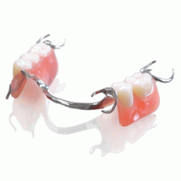 SunCast® Standard Partial Dentures by Sun Dental Laboratories LLC