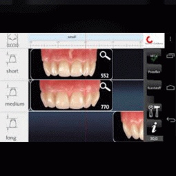 ToothScout by Candulor USA Inc.