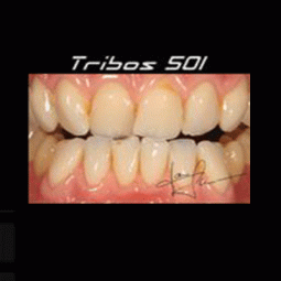 Tribos 501 by Schutz Dental Group