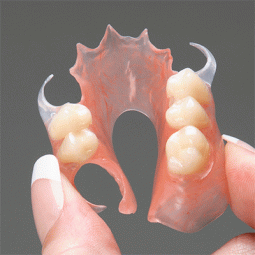 DuraFlex™ Flexible Partial by Oral Arts Dental Laboratories, Inc.