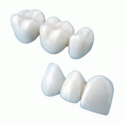 Milled Interim Crowns and Bridges by Aurum Ceramic Dental Laboratories LLP