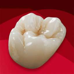 BruxZir® Full Zirconia Crowns and Bridges by Ziemek Aesthetic Dental Lab Inc