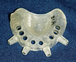 Figure 5  Printed CAD-CAM surgical template developed from the CT scan and planning software. This is used during the placement of the implants to guide the exact position, angulation, and depth of the implants.