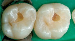 Figure 7  Aspect of the prepared cavities.