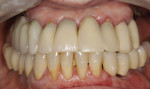 Figure 1 and Figure 2 Close-up view and patient smile before treatment.
