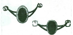 Figure 3  Delabarre’s obturator with clasps similar to conventional removable partial denture. (Taken from: Aramany MA. A history of prosthetic management of cleft palate: Pare′ to Suersen. Cleft Palate J. 1971;8:415-430.)