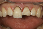 Figure 8 Dentin layer.