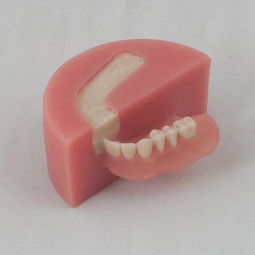 CAD/CAM Denture System by Nobilium