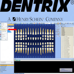 Dentrix® G5 by Dentrix®/Henry Schein Practice Solutions