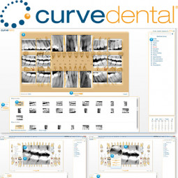 Curve Dental Practice Management Software by Curve Dental, Inc.