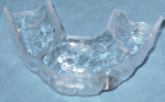 Figure 7 CAD/CAM implant surgical guide to replace congenitally missing tooth No. 10.