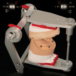 Figure 1 Master casts are mounted on the articulator.