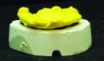 The occlusal record is place on a resin jig after indexing base.